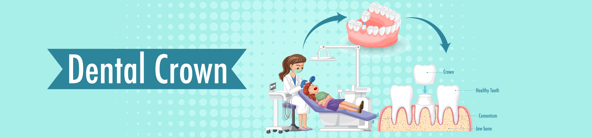 Dental Crown Cost in Mumbai India - Dr. Karve's Dentech